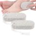 Stone For Feet Remover for Dead Skin 2 Pieces Pumice Stone for Heels Hands Palms Elbows and Body of Adults