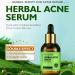 Anti-acne cream adolescent acne treatment herbal essence acne elimination various acne intensity antibacterial inhibition acne growth repair facial skin herbal acne essence treatment - Buy Online on GoSupps.com