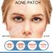 Pimple Patches Acne Stickers Hydrocolloid Patches Large Acne Stickers for Face Chin or Body Effectively Calms & Relieves Acne (80 Patches) - Buy Online on GoSupps.com