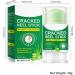 Foot Cream - Fast Absorbing Non-Greasy Moisturizing Care for Cracked Feet - For Knees Elbows Rough Skin and Soles - For Women Adults Travel and Home - Buy Online on GoSupps.com