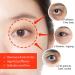 Buy LJHG Magic Wrinkle Eye Cream | Best Solution for Eye Bags - 1PCS | International Shipping - Buy Online on GoSupps.com