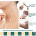 Silicone Scar Removal Sheets for C-Section Surgery, Burns, Acne, Keloids & Stretch Marks - Washable & Reusable - Effective on Old & New Scars - 4 Pack - Buy Online on GoSupps.com