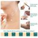 Silicone Scar Removal Strips - C-Section, Surgery, Burns, Acne, Stretch Marks - 4 Sheets - Buy Online on GoSupps.com