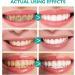 2PC Whitening Toothpaste - Fluoride-Free Mint Foaming Oral Care | Reduce Plaque & Lighten Teeth | 60ml - Buy Online on GoSupps.com