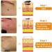 2pc Turonu Bee Venom Treatment Cream 2024 New Professional Bee Venom Repair Cream Hydrating Moisturizing Repair Cream for All Parts of The Body - Buy Online on GoSupps.com