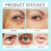 Retinol Eye Balm Stick Moisturized Anti-Aging Gentle Eye Balm with Hyaluronic Acid Dark Circles & Puffiness Reduces Fine Lines Hydrating Firming Treatment for Under Eye Bags 0.25oz - Buy Online on GoSupps.com