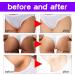 Brightening Intimate Parts Whitening Cream Whitening Cream Brightening Cream for Armpits Skin Lightening Cream Armpit Whitening Cream Effective For Armpits Elbows (2) - Buy Online on GoSupps.com