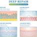 Medical Grade Silicone Scar Sheets - Reusable Scar Removal Tape for Surgical C-Section Keloid and Acne Scars - 1.6 x 60 Roll - Buy Online on GoSupps.com