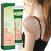 Vitiligo Moisturizing Cream & Lotion Set - Skin Repair Gel | 4PCS - International Shipping - Buy Online on GoSupps.com