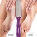 Probelle Double Sided Multidirectional Nickel Foot File Callus Remover - Immediately Reduces calluses and Corns to Powder for Instant Results Safe Tool (Purple) - Buy Online on GoSupps.com