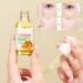 Turmeric Serum Dark Spots 30 ml Spot Corrector Face & Body Anti Aging and Wrinkle Face Serum Reduces Hyperpigtation Age Spots Sun Spot Improve Skin Tone Moisturize Brighten All Types - Buy Online on GoSupps.com