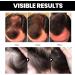 Batana Oil for Hair Growth 100 Natural Organic Batana Oil for Healthy Hair Anti Thinning Oils for Hair Moisturizing - Buy Online on GoSupps.com
