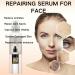 Snail Mucin Essence 98 Snail Mucin Snail Mucin Serum Snail Mucin 98% Power Repairing Essence Skin Repair Face Serum Hyaluronic Acid Essence with Snail Secretion Filtrate for Face Dull Skin - Buy Online on GoSupps.com
