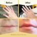 ECZEMA HONEY Survival Kit - Skin Soothing Cream Body Lotion Hand Cream & Lip Balm - Natural Eczema Treatment for Sensitive Skin - Itch Relief for Psoriasis Dermatitis & More - Buy Online on GoSupps.com