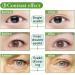 5MM Natural Invisible Eyelid Tape Stickers - 288pcs, Medical-use Fiber, Instant Eye Lift Without Surgery - Perfect for Uneven Mono-Eyelid - Buy Online on GoSupps.com
