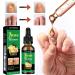 7 Days Ginger Nail Treatment | Strengthener & Growth Oil for Healthy Nails - Buy Online on GoSupps.com