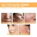 Glycolic Acid 7% Toning Solution Glycolic Acid Toning Resurfacing Solution Hydrating Toning Solution Glycolic Sour 7% Toner Skincare Hyaluronic Acid Serum Resurfacing Solution Exfoliating Brighten - Buy Online on GoSupps.com