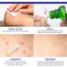 Dr. Luke Fast Action Liquid Wart Remover | Effective Wart Treatment for Men & Women - Genital Common Filiform & Flat Warts - Buy Online on GoSupps.com