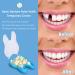 50pcs/Box Resin Temporary Crown for Front Teeth - False Teeth Material for Oral Care - Buy Online on GoSupps.com