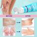 Buy Urea Cream 42% - Ultimate Foot Care Lotion with Salicylic Acid & Tea Tree Oil for Dry Cracked Heels - 4 oz - Buy Online on GoSupps.com