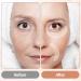 12 Pieces Face Anti Wrinkle Patches Silicone Eye Wrinkle Pads Anti Aging Reusable Silicone Pads Lip Wrinkle Patches Face Wrinkle Treatment Prevention Strips Wrinkle Resistant Eliminate Wrinkles - Buy Online on GoSupps.com