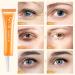 Eye Cream for Dark Circles and Puffy Eyes Snail Eye Cream Eye Bags Remover Eye Cream Anti Aging Under Eye Cream Reduce Lines Wrinkles Puffiness and Dark Circles for All Skin Types - Buy Online on GoSupps.com
