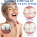 3-Piece Toothbrush Stain Remover Set | Jinsihu Tartar Remover for Professional Tooth Cleaning & Plaque Removal - Buy Online on GoSupps.com