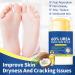 Anti-Crack Foot Cream Stick - 40g Non-Greasy Balm Stick - Moisturizing Heel Cream for Women and Men for Rough Skin for Winter Care of Cracked Heels - Buy Online on GoSupps.com