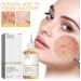 Glycolic Acid 7% Toning Solution Glycolic Acid 7% Toning Resurfacing Solution Glycolic Acid Skin Toner for Blemishes and Acne Facial Exfoliation Glycolic Acid Serum Skincare Hydrating Toner (100ml) - Buy Online on GoSupps.com