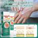Psoriasis Cream 20ml - Fast Absorbing Formula for Chapped Skin Relief, Itch Relief Hand Ointment - Buy Online on GoSupps.com