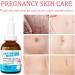 Stretch Mark Pregnancy Massage Oil - Improve Skin Fade Stretch Marks Ideal Skincare for New Moms - 30 ml - Buy Online on GoSupps.com