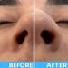 Nose Strips for Nasal Congestion Relief | Anti Snoring Strips for Better Sleep - 64 Non-Invasive Clear Strips for Men & Women | International Shipping Available - Buy Online on GoSupps.com