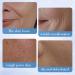 Cr me anti-rides au r tinol pour le visage - 60 g - Cr me hydratante pour le visage - Apaise et att nue les rides - Cr me anti-rides facile p n trer - Pour le cou et le d colet  - Buy Online on GoSupps.com