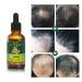 Ginger Hair Growth Serum- Stop Hair Loss & Support Healthy Hair - 30ML (1.01 Fl oz) - Buy Online on GoSupps.com