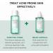 SKIN1004 Tea-Trica Purifying Toner 210ml - Soothing Hydration & Acne Care | International Shipping Available - Buy Online on GoSupps.com