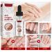 Kerassentials Anti-Fungus Relief Oil for Toenail Fungus - Strong Nails Solution (3pcs) - Buy Online on GoSupps.com