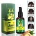 Advanced Hair Growth Serum - Accelerate Growth Thicken & Regrow Hair Anti-Hair Loss Treatment for Thin Hair - Buy Online on GoSupps.com