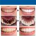Sp-Y6 Probiotic Toothpaste Sp-Y6 Probiotic Teeth Whitening Agent Teeth Whitening Toothpaste for Fresh Breath Removes Yellow Stains Whitens Teeth - Buy Online on GoSupps.com