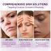 Marianp Hyaluronic Acid Serum & Azelaic Acid 10% for Acne Pigmentation & Rosacea - Vitamin B3 & B5 | Best Skincare Treatment - Buy Online on GoSupps.com