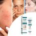 Dark S Corrector Cream Whiten S Moisturizer Skin Brightening Cream Facial Brightening Moisturizer Deep Skin Brightening Skin Tone Corrector Dark Remover Age S Cream - Buy Online on GoSupps.com