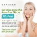 Exposed Skin Care Clearing Tonic Step 2 - Acne Clearing Toner with Salicylic Acid & Green Tea - 4 fl oz - Buy Online on GoSupps.com