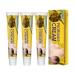 Inalsion Revitaskin Eczema Cure Cream Eczema Treatment Cream Eczema Psoriasis Cream Eczema Relief Cream Skin Cream for Eczema and Psoriasis for Adults (3pcs)