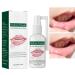Mouth Ulcer Treatment Spray Mouth Ulcer Spray Canker Sore Treatment for Adults Oralcare Propolis Ulcer Relief Spray Herbal Mouth Spray Canker Relief Spray Breath Spray for Bad Breath Breath Freshener