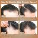 5% Minoxidil & Biotin Hair Growth Serum - 60ML for Men and Women | Hair Regrowth Treatment for Thicker, Longer, Healthier Hair | Prevent Scalp Hair Loss | Natural Formula for Fuller Hair - Buy Online on GoSupps.com