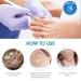 Professional Ingrown Toenail Treatment Kit - 60PCS Toenail Corrector Strips, File, and Lifter - Painless Pedicure Tool for Ingrown Toenails - Buy Online on GoSupps.com