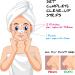 T-Zone and Nose Clear-Up Strips - Blackhead Patches and Cleansing Face Impurities Forehead + Nose + Chin - T Zone Patch for All Types of Pores and Skin - Buy Online on GoSupps.com