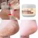 100% Natural Foot Care Cream for Dry Skin & Cracked Heels | Glycerin Infused | Soothes & Refreshes Tired Feet - Buy Online on GoSupps.com