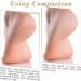Cracked Heel Repair Socks - 2Pairs Moisturizing Heel Socks for Cracked Heels Moisturizer Spa Socks for Dry Cracked Feet Overnight Foot Care Lotion Socks for Women (UK Szie 5-9) - Buy Online on GoSupps.com