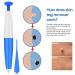Skin Tag Remover Kit - Easy Application Device for Small to Medium Skin Tags (2mm-5mm) - Blue Kit - Buy Online on GoSupps.com