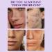 Dark Spot Corrector Serum Niacinamide Serum Brightening Serum Niacinamide+ 5% Tranexamic Acid Hydrating Serum Dark Spot Corrector For Face Age Spot Remover For Face Face Redness Remover - Buy Online on GoSupps.com